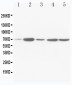 Anti-SDHA Antibody